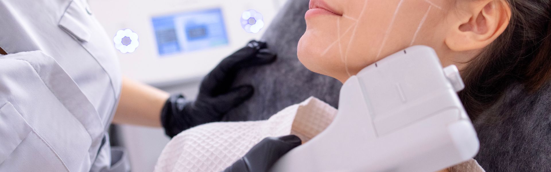 HIFU: lifting sin cirugía para rejuvenecer la piel thumbnail