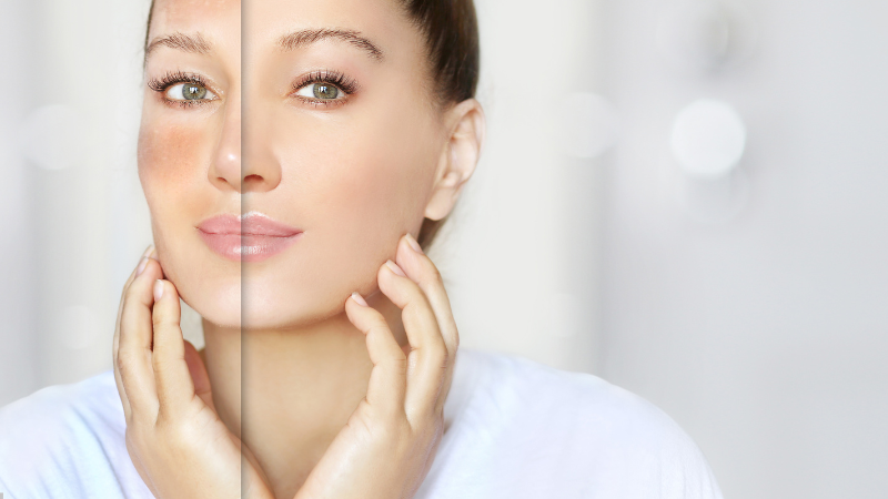 Cómo preparar la piel para el invierno: cuidados esenciales thumbnail